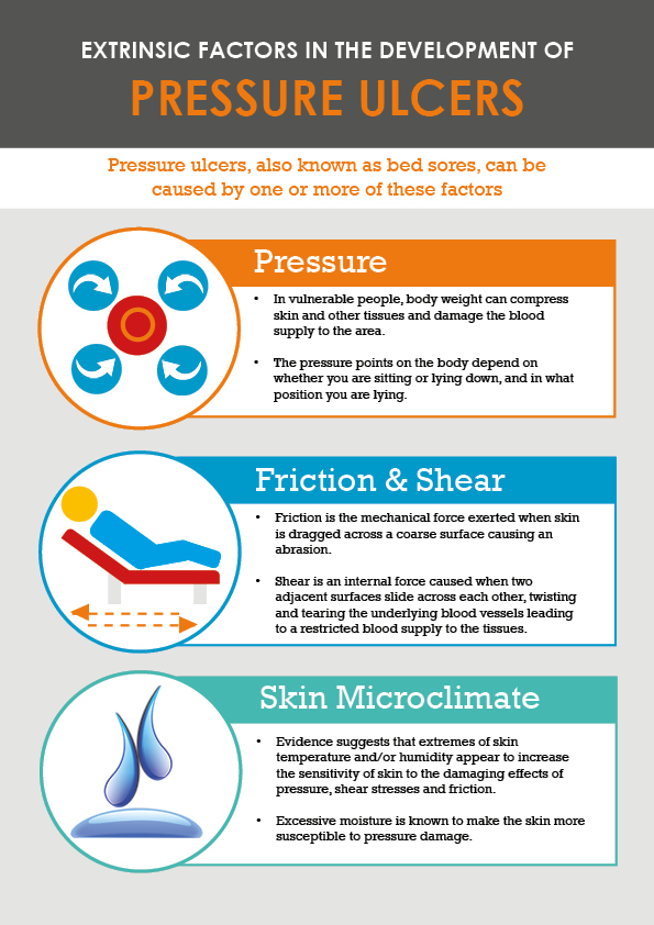 https://www.selectmedical.co.uk/wp-content/uploads/2019/04/extrinsic-factors-in-pressure-ulcer-development.jpg